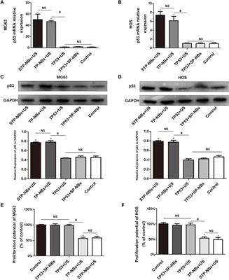 A noval noninvasive targeted therapy for osteosarcoma: the combination of LIFU and ultrasound-magnetic-mediated SPIO/TP53/PLGA nanobubble